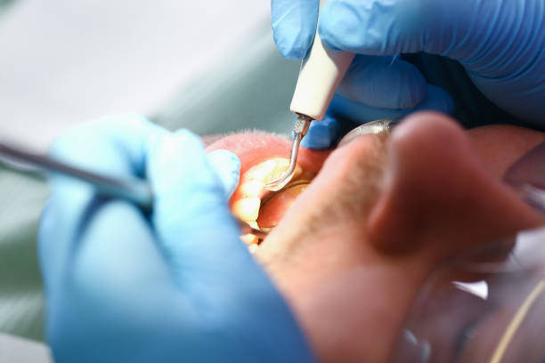 Best Emergency Dental Surgery in Claremore, OK