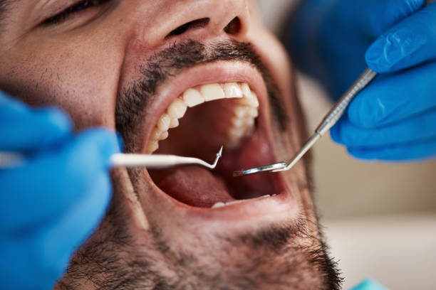 Best Emergency Dental Care for Trauma or Injury in Claremore, OK